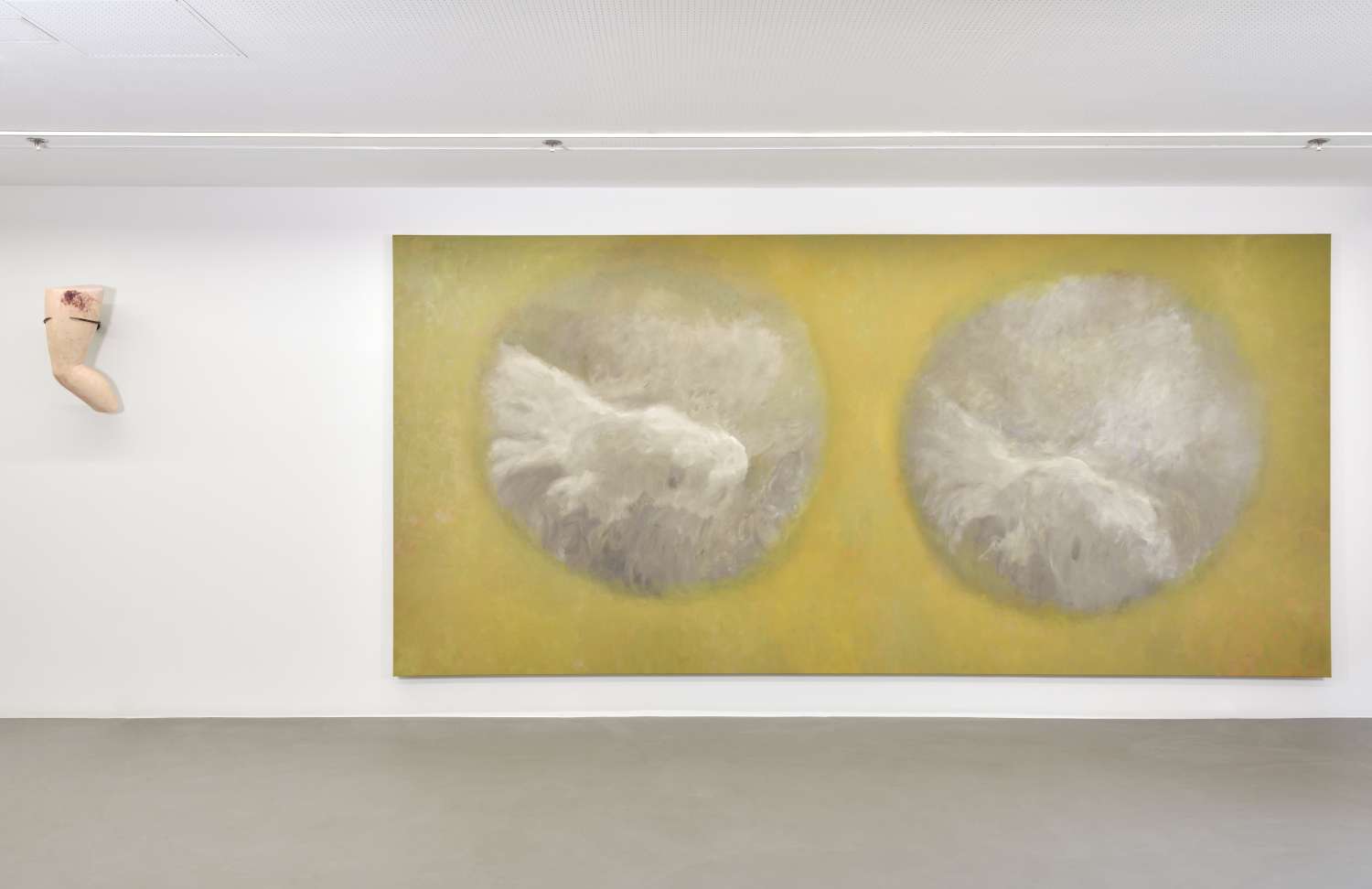  IT’S ONLY ACHILLES’ HEEL THAT’S LEFT ALIVE. Photo 4