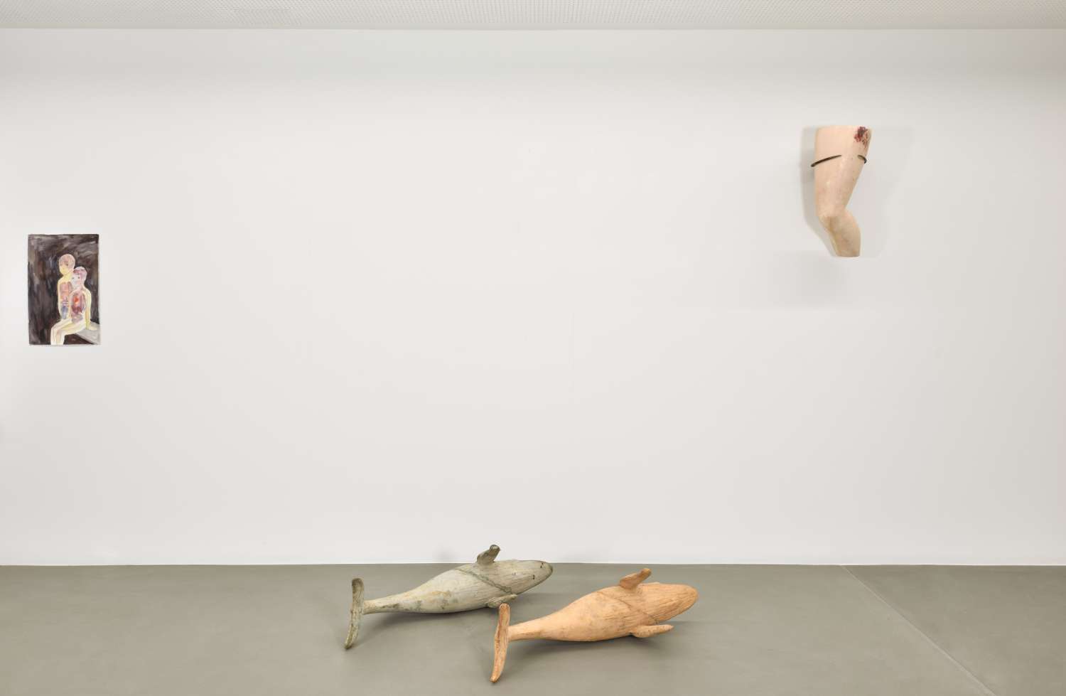  IT’S ONLY ACHILLES’ HEEL THAT’S LEFT ALIVE. Photo 5