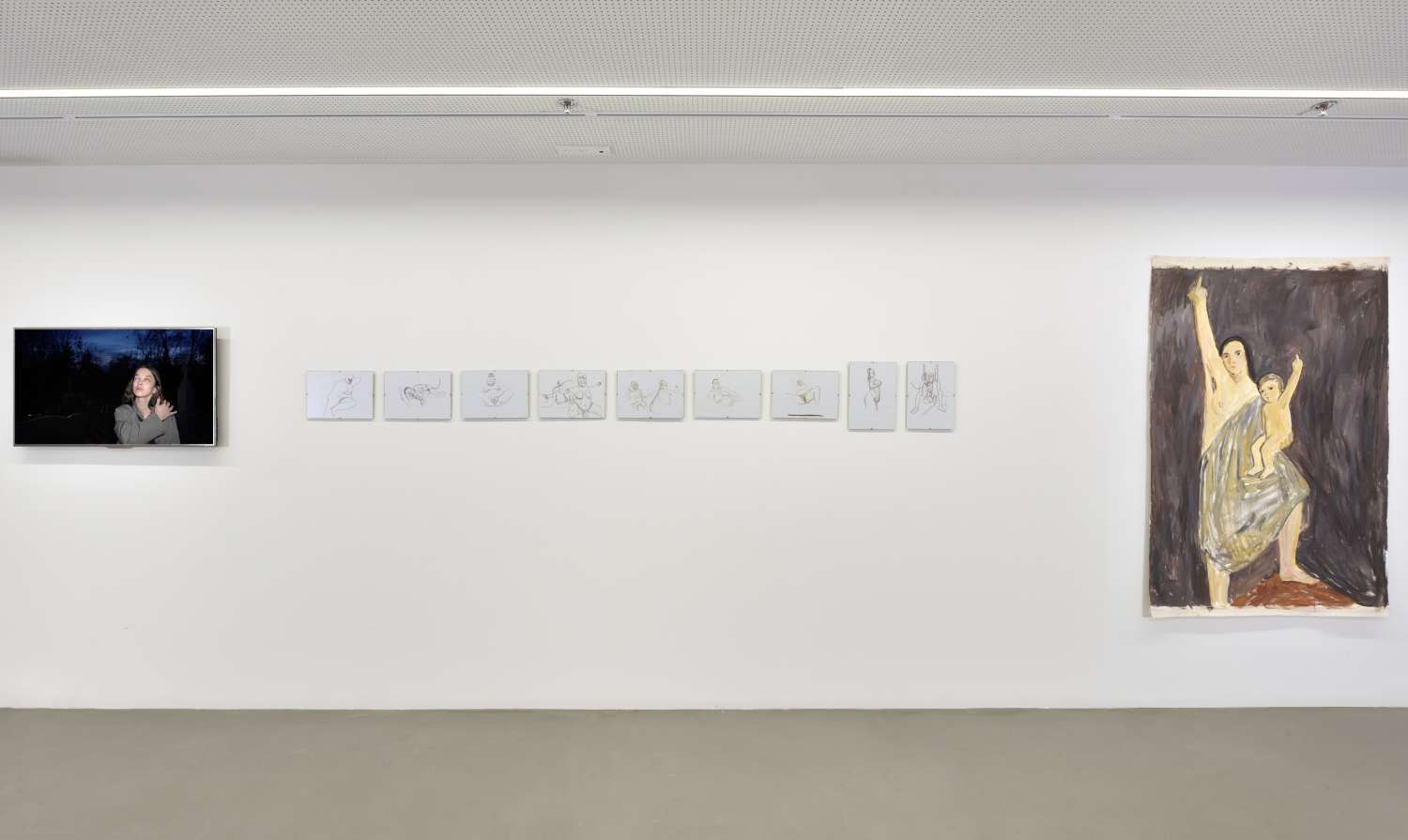  IT’S ONLY ACHILLES’ HEEL THAT’S LEFT ALIVE. Photo 6