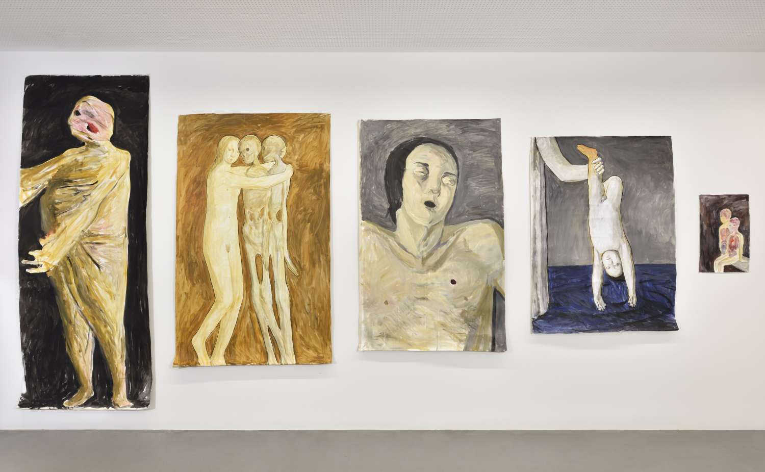  IT’S ONLY ACHILLES’ HEEL THAT’S LEFT ALIVE. Photo 7