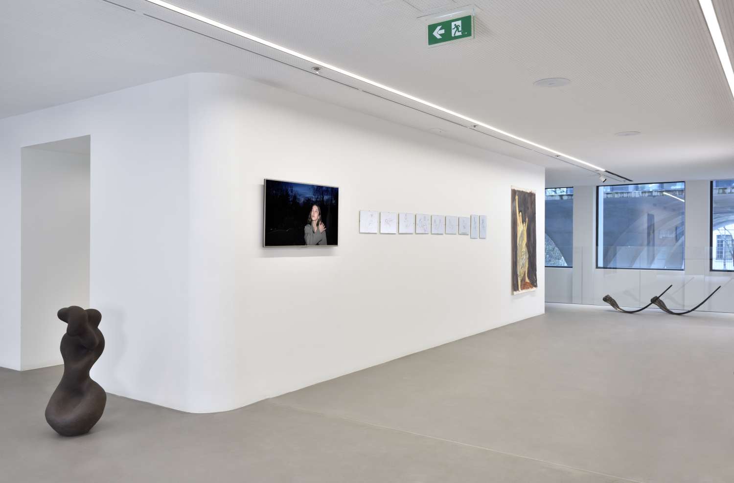  IT’S ONLY ACHILLES’ HEEL THAT’S LEFT ALIVE. Photo 9